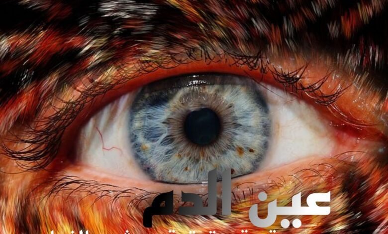 قصه عين الدم 11 316036253 1104803870147288 3823834779117881050 n